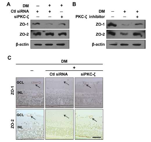 당뇨망막병증의 허혈에 의한 망막 손상에서 calcium매개의 PKC zeta 신호전달기전의 작용가능성 확인