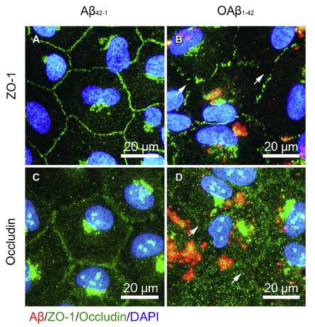 망막허혈과 노인성 망막변화에서 amyloid beta에 의한 치밀이음부 변화 확인