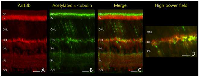 망막허혈에 의한 망막세포 사멸 등의 신호전달기전 변화의 중심인 cilia의 망막조직 내 발현 확인