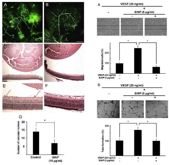 망막혈관신생에 대한 sphere형태의 silicate나오입자에 의한 혈관신생 기전 조절을 통한 억제 효과