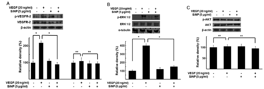 Sphere형 나노입자의 혈관내피세포성장인 신호전달기전의 직접적인 조절을 통한 혈관신생억제 효과