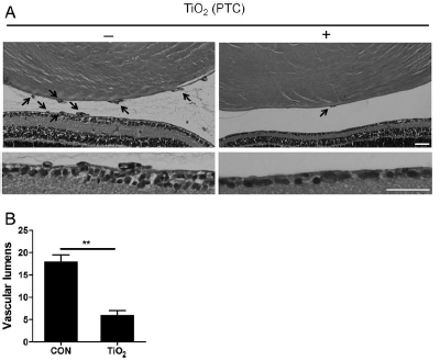 Sphere형 TiO2 나노입자의 VEGFR2 신호전달기전 억 제를 통한 망막혈관신생 억제 효과 확인