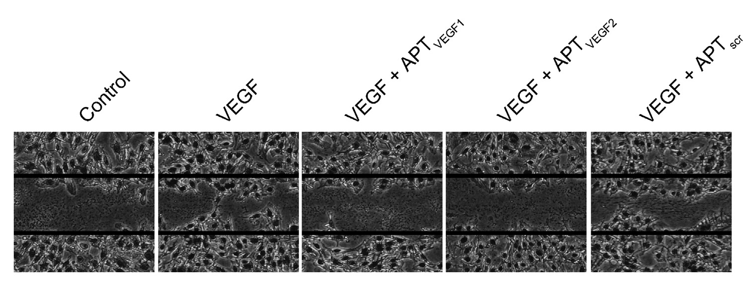 망막혈관신생의 주요 조절인자인 VEGF를 제어하기 위한 high-affinity peptide효과 규명