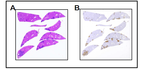 대장암 세포주의 투여를 통한 전이성 간 암모델. (A) H&E 염색을 통한 간 조직 내의 암 발 생 양상. (B) CK20 염색을 통해 H&E에서 관찰된 암 조직이 대장암임을 나타내는 갈색으로 관찰됨을 확인