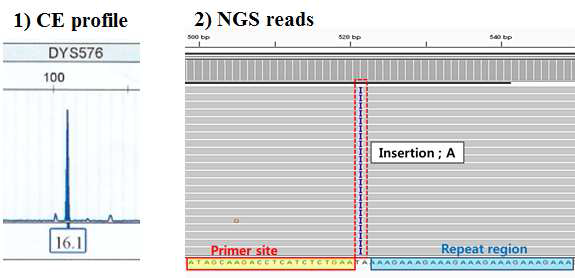 DYS576에서 확인한 CE와 NGS 결과의 차이