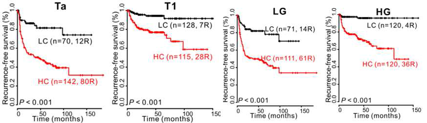 Stage (Ta, T1) 및 grade (LG, HG)에 따른 CCNB1 연관유전자들의 예후 예측