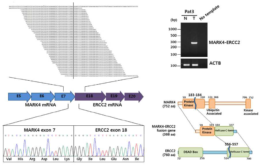 MARK4-ERCC2 Fusion Gene (Kim et al., 2013)