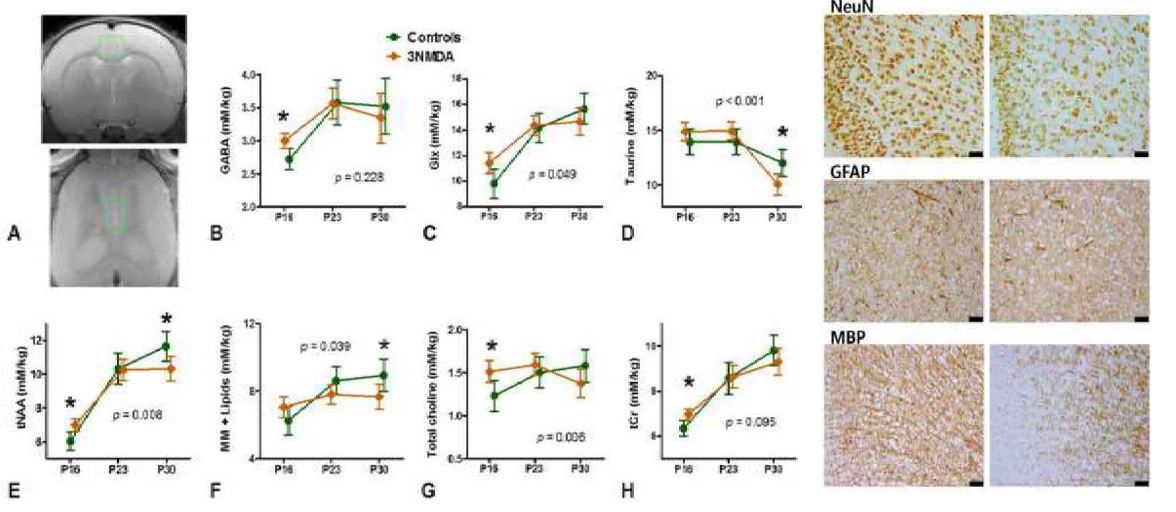 Neurochemical changes in rats with NMDA-induced spasms using 1H-MRS findings.