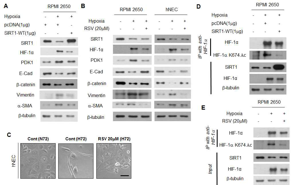 비강상피세포에서 Sirt1에 의한 HIF-1 전사기능 억제 및 morphology 변화 확인