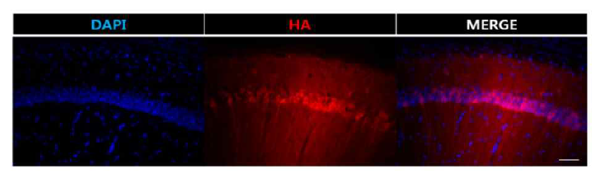 흥분성 뉴런에 과발현된 HA-SHP2