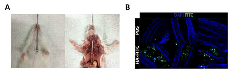 마우스에게 EGF를 전달할 목적으로 사용된 경구존대 (A)와 경구존대를 이용해 HA-FITC를 식도에 전달하고 조직검사를 통해 식도 관찰(B).