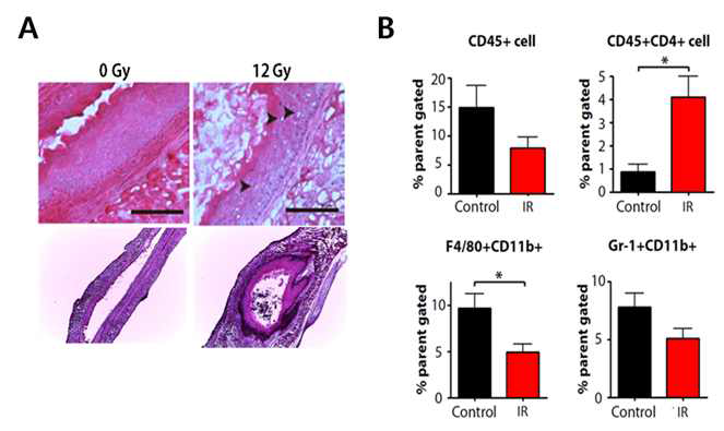 in vivo 방사선 유발 식도염 모델에서 식도 적출 후 시행한 조직 병리학적 검사 (A)와 침윤하는 면역세포 동정(B).