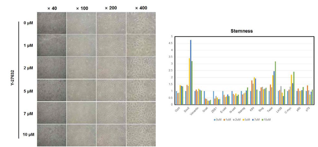 Y-27632를 농도별로 처리하면서 장기간 배양하는 동안 세포 모양를 관찰하였음. Y-27632의 농도에 따른 줄기세포 및 상피-간엽 전이 마커의 발현 변화를 살펴봄.