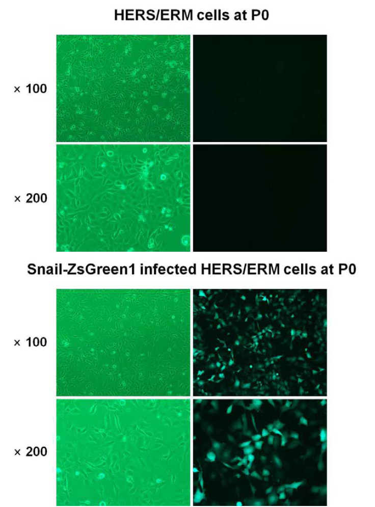 Snail 과발현용 바이러스를 infection 후 48시간 째 형광현미경 사진