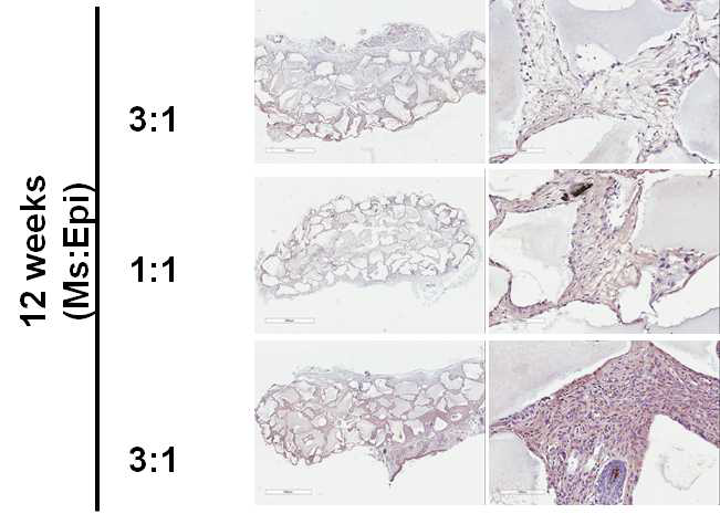 상피와 중간엽을 다양한 비율로 섞은 후 이식함. 이식 후 12주째 amelogenin의 면역염색결과