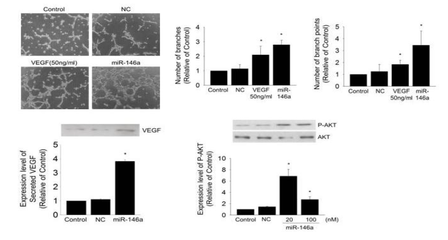 miRNA-146a에 의한 신생혈관형성 강화
