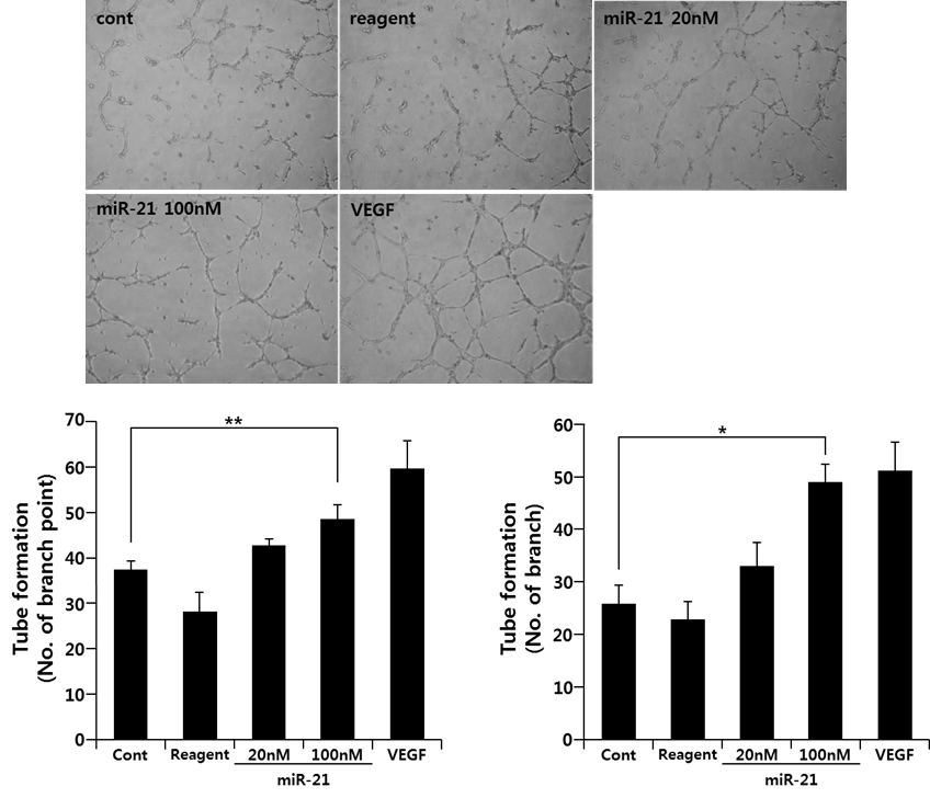 miR-21에 의한 VEGF의 발현증가로 인한 신생혈관 형성 강화 확인
