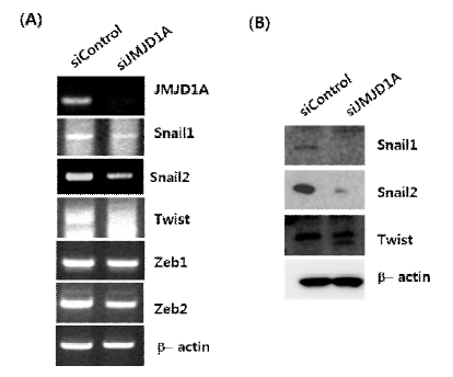 MDA-MB-231 세포주내에서 KDM3A의 결핍에 의해 발현 조절되는 EMT 촉진전사인자