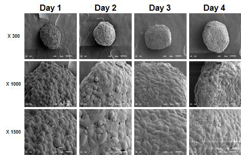 아가로스 디바이스에서 형성된 LNCap-LN3 세포 구상체의 세포-세포 결합상태 관찰을 위한 전자현미경 사진