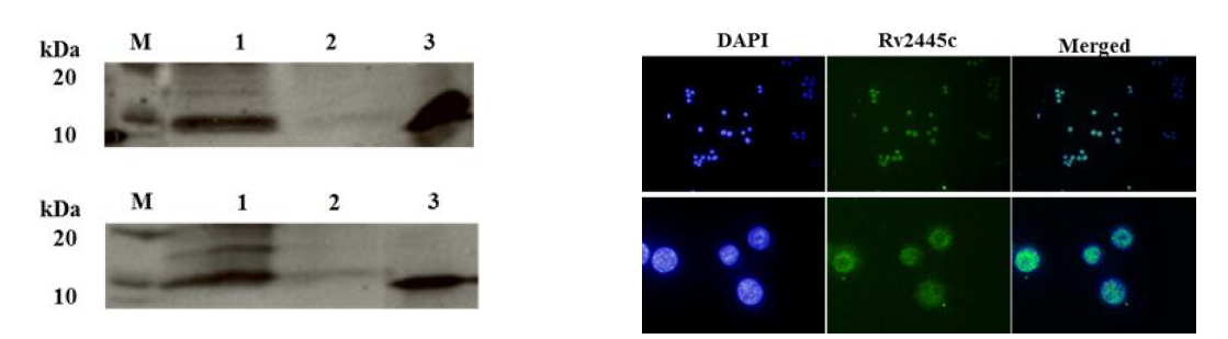 결핵균 배양액으로부터 분비된 Rv2445c 단백검출 및 배양세포에서의 발현여부확인