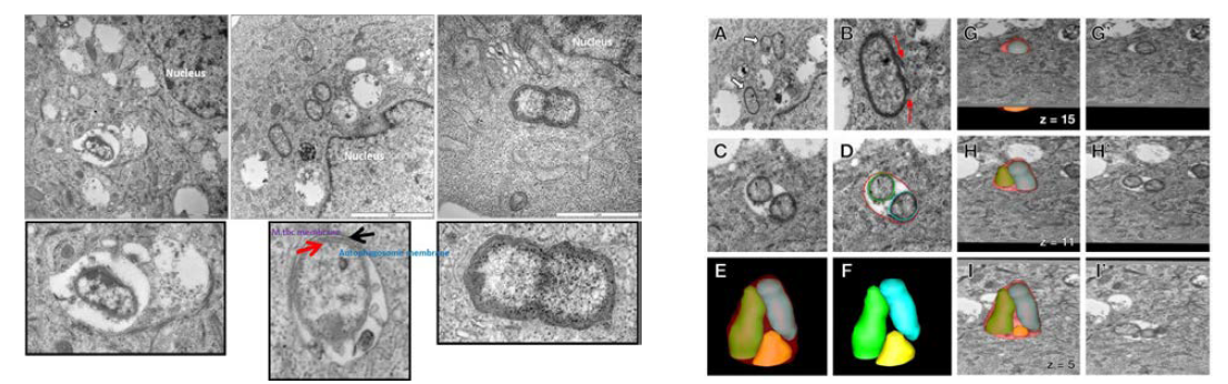 결핵균이 감염된 감염세포의 전자현미경 분석