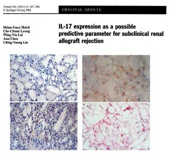 IL-17과 subclinical rejection의 연관성