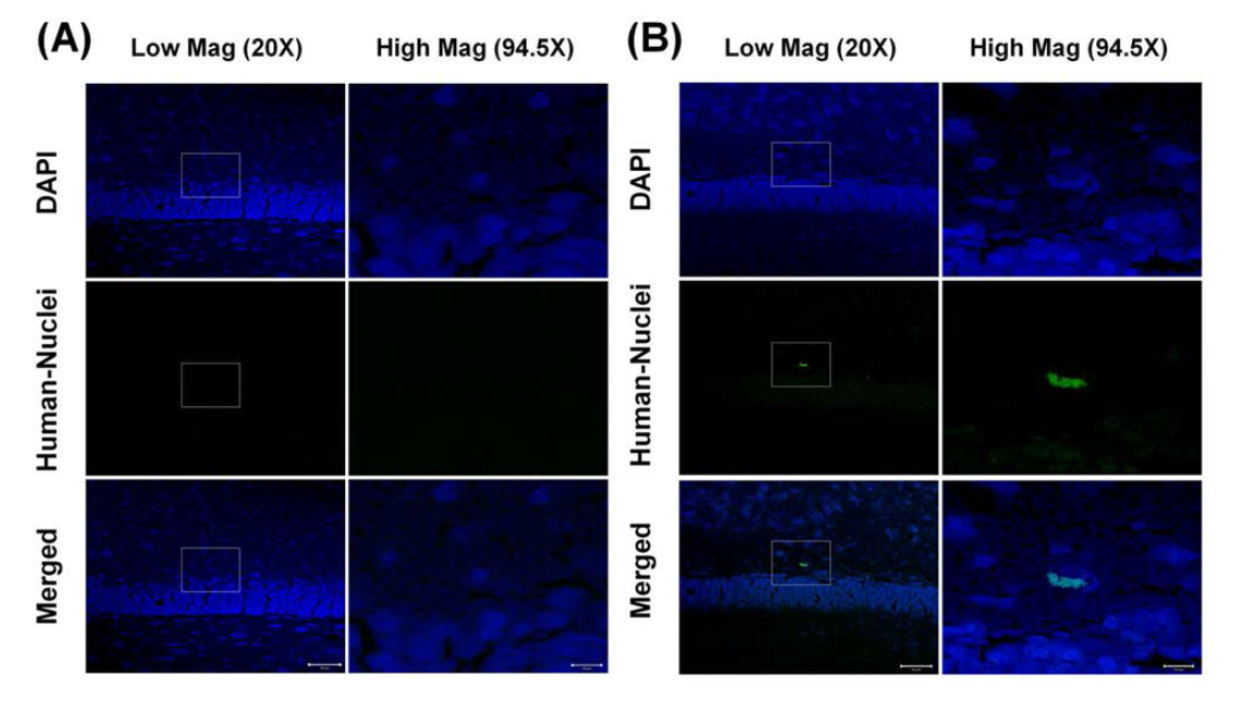 실험동물 뇌 조직의 DAPI (4′,6-diamidino-2-phenylindole), 및 anti-human nuclei antibody 염색 이미지