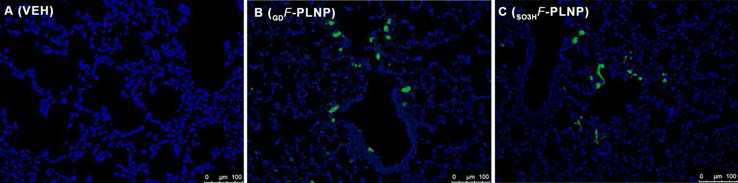 폐 조직에 대한 형광현미경 확인(나노입자는 녹색 형광으로 표지하였음).