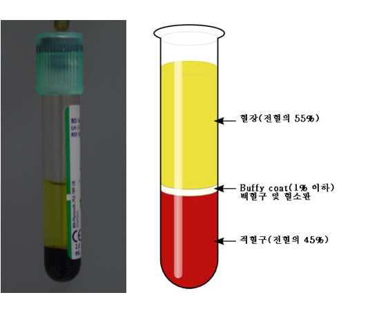 원심 분리를 통해 3 층으로 나뉘어진 혈액.