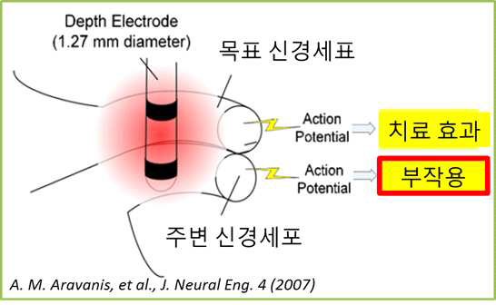 전기적 자극의 문제점의 예