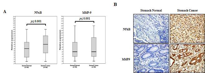정상조직과 위암 조직에서의 NF-kB, MMP-0의 발현을 조직면역염색방법으로 확인