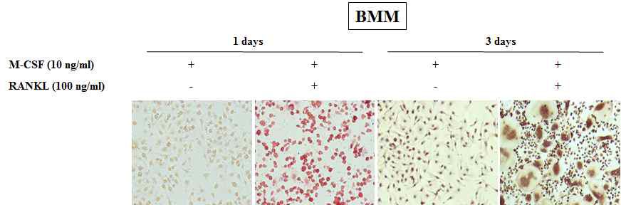 In vitro에서 BMM 세포를 이용한 골다공증 유사 모델 구축