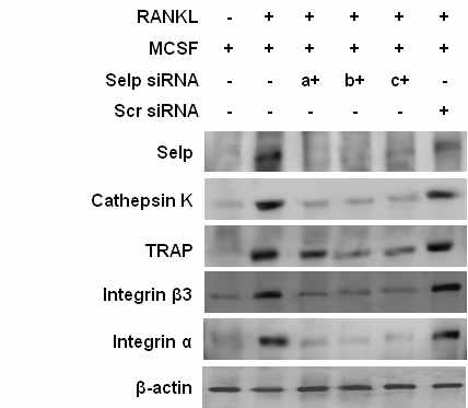 Selp siRNA에 의한 파골세포 분화 marker의 발현변화 관찰