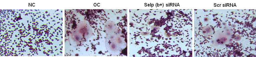 Selp siRNA에 의한 파골세포의 morphology 변화와 TRAP 염색 관찰
