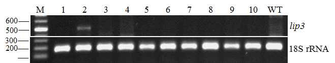 Reverse transcriptome PCR를 통한 lipase 발현