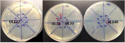 Yeast two hybrid 를 이용한 viperin과 상호작용하는 CMV 단백질의 선별