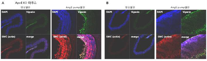 Angiotensin II pump ApoE KO 마우스에서 형성된 신생혈관내막 및 외막에서 viperin을 발현하 는 세포 동정