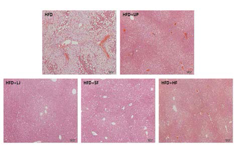 16주의 해조류 첨가 고지방 식이를 섭취한 간의 H&E staining 결과