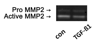TGF-β1을 처리한 섬유모 세포에서 MMP2의 발현이 감소
