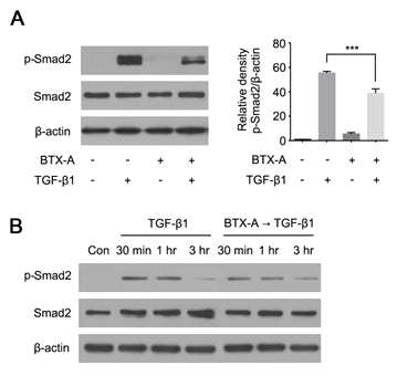보툴리늄 독소와 TGF-β 처리에 의한 pSmad2의 발현
