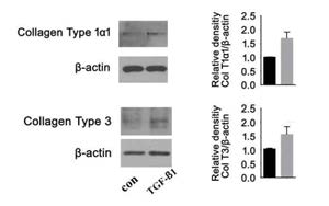 TGF-β1을 처리한 섬유 모세포에서 콜라겐의 생성이 증가