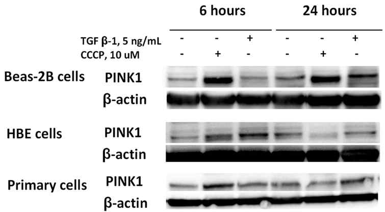 in vitro 모형(폐상피세포)에서의 PINK1 발현