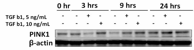 in vitro 모형(폐상피세포)에서의 TGF-β1 자극에 대한 PINK1 의 용량별, 시간별 발현