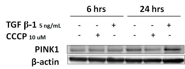 in vitro 모형에서(폐섬유아세포) TGFb1 자극에 대한 PINK1 의 발현