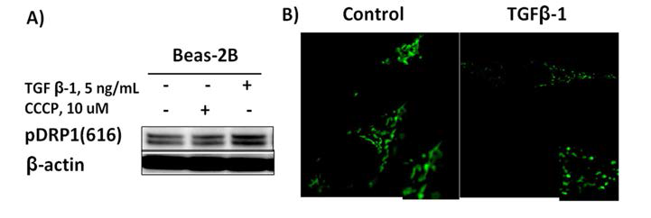 in vitro 모형에서(폐상피세포) TGF-β1 자극 후 phospho-DRP1 증가 및 fission