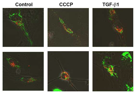 Beas-2B 세포에서 TGF-β1 자극에 의한 mitochondria와 lysosome의 위치변화