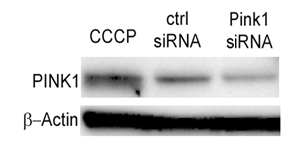 PINK1 siRNA의 효과