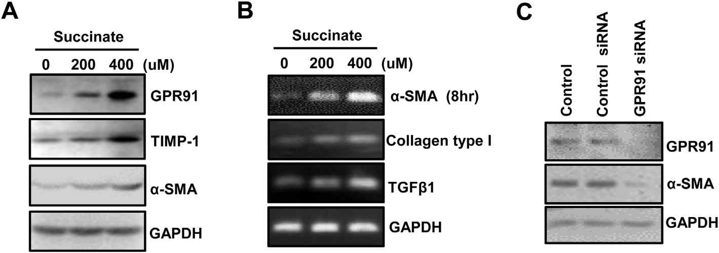 Succinate 및 GPR91 si RNA처리시 a-SMA의 발현