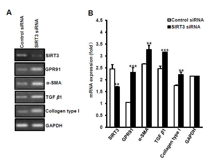 간성상세포에 Sirt3 si RNA를 처리시 간성상세포 활성화 마 커들의 변화