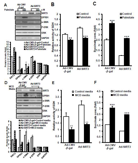 간성상세포에 SIRT3 adenoviral overexpression후 palmitate 및 MCD medium을 처리시 SDH, Succinate, GPR91, ɑ-SMA의 변화
